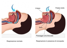 disturbi del sonno: respirazione corretta e OSAS