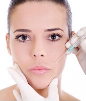 filler studio filosa chirugia estetica